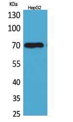 Rabbit Polyclonal Antibody to Glypican-3
