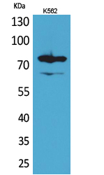 Rabbit Polyclonal Antibody to FOXP1