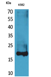 Rabbit Polyclonal Antibody to Lipocalin-1