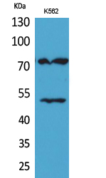 Rabbit Polyclonal Antibody to HDC