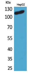 Rabbit Polyclonal Antibody to DPYD