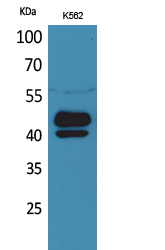 Rabbit Polyclonal Antibody to PSG1