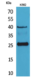 Rabbit Polyclonal Antibody to CD161