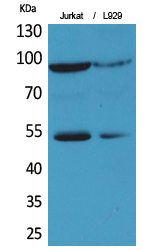 Rabbit Polyclonal Antibody to EPAS-1