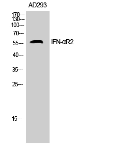 Rabbit Polyclonal Antibody to IFN-αR2