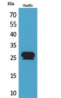 Rabbit Polyclonal Antibody to CacyBP