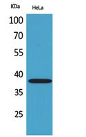 Rabbit Polyclonal Antibody to CD158b2/j