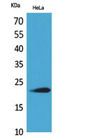 Rabbit Polyclonal Antibody to IFN-ω