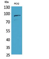 Rabbit Polyclonal Antibody to PCAF