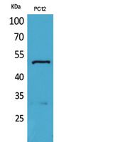 Rabbit Polyclonal Antibody to Tubulin α