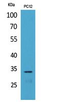 Rabbit Polyclonal Antibody to CD74