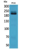 Rabbit Polyclonal Antibody to Integrin β4