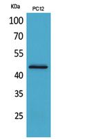 Rabbit Polyclonal Antibody to IL-1RII