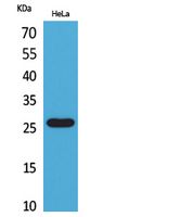 Rabbit Polyclonal Antibody to DCL-1