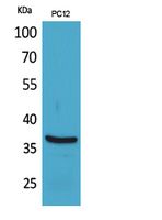 Rabbit Polyclonal Antibody to BST-1