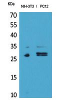 Rabbit Polyclonal Antibody to DcR1
