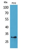 Rabbit Polyclonal Antibody to HLA-DQB1/2
