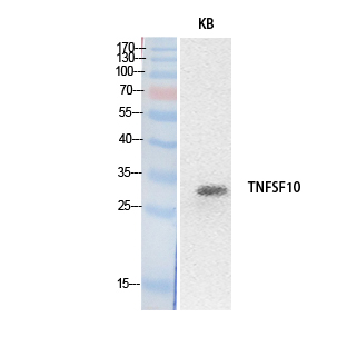 Rabbit Polyclonal Antibody to TRAIL