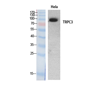 Rabbit Polyclonal Antibody to TRPC3