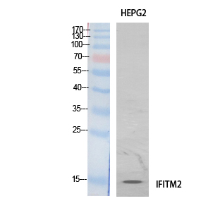 Rabbit Polyclonal Antibody to IFITM2