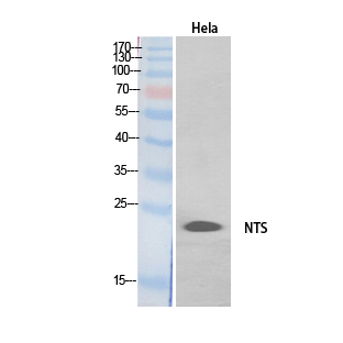 Rabbit Polyclonal Antibody to Neurotensin