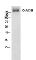 Rabbit Polyclonal Antibody to C4a/b