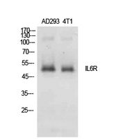 Rabbit Polyclonal Antibody to IL-6Rα