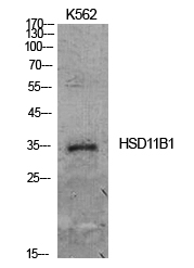 Rabbit Polyclonal Antibody to 11β-HSD1