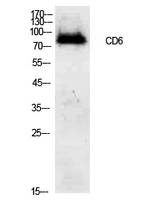 Rabbit Polyclonal Antibody to CD6