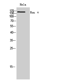 Rabbit Polyclonal Antibody to Ron α