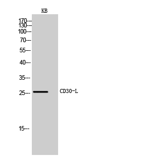 Rabbit Polyclonal Antibody to CD30-L