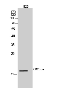 Rabbit Polyclonal Antibody to CD235a