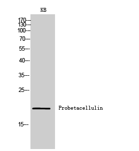 Rabbit Polyclonal Antibody to Probetacellulin
