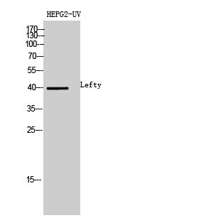 Rabbit Polyclonal Antibody to Lefty