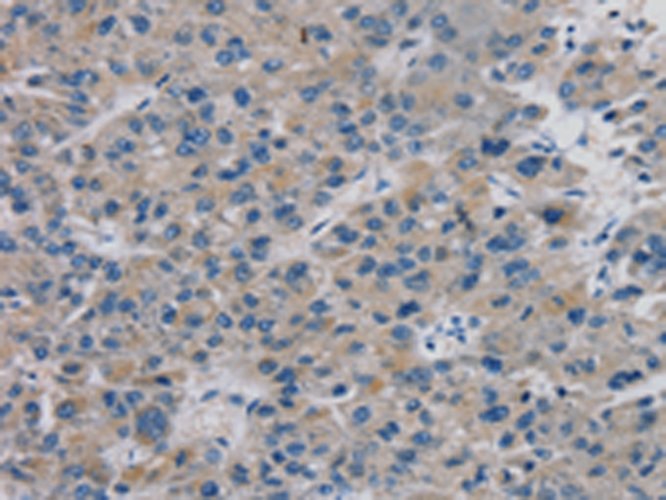 Rabbit Polyclonal Antibody to TBX18