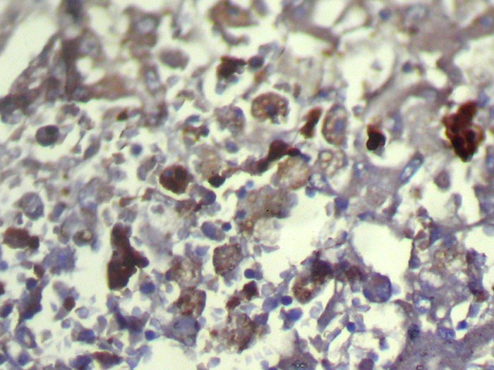 Rabbit Polyclonal Antibody to TXNDC11