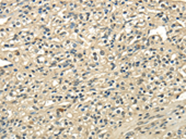 Rabbit Polyclonal Antibody to USP1