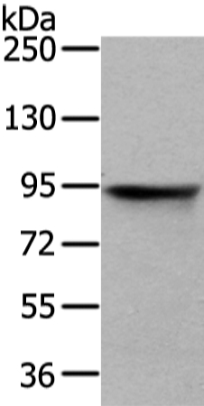 Rabbit Polyclonal Antibody to VIL1
