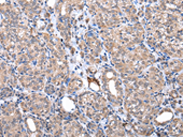 Rabbit Polyclonal Antibody to ZNF217