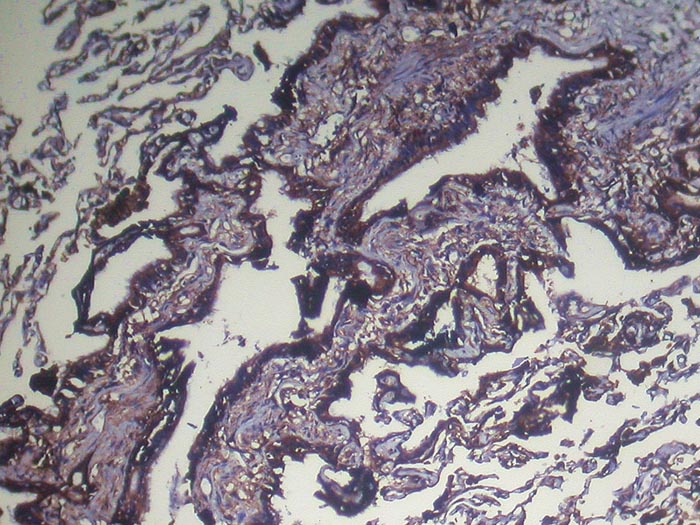 Rabbit Polyclonal Antibody to NUDT4