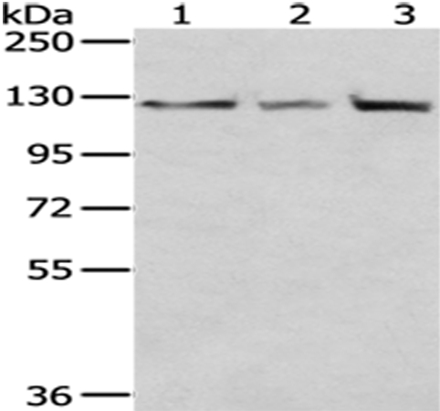 Rabbit Polyclonal Antibody to IPO5