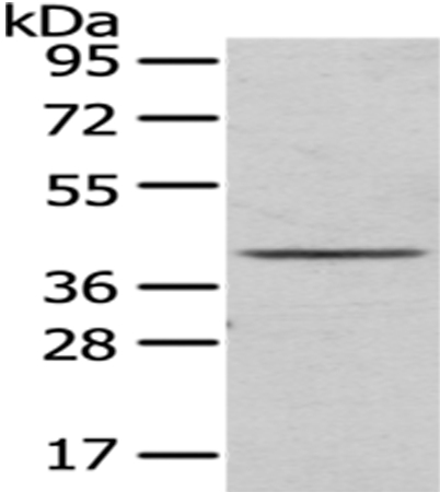 Rabbit Polyclonal Antibody to TOR1A