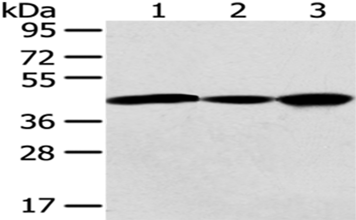 Rabbit Polyclonal Antibody to GNAO1