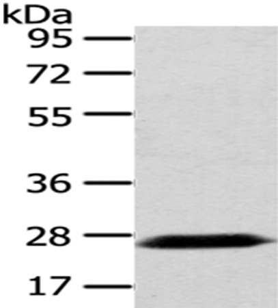 Rabbit Polyclonal Antibody to PDZK1