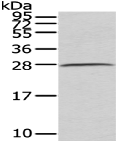 Rabbit Polyclonal Antibody to C1QB