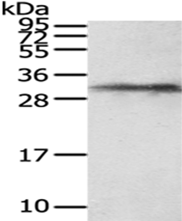Rabbit Polyclonal Antibody to HUS1