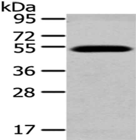 Rabbit Polyclonal Antibody to TCN2