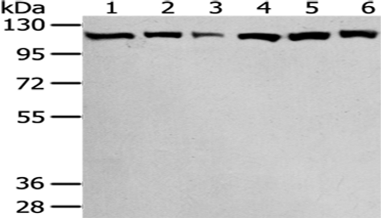 Rabbit Polyclonal Antibody to SND1