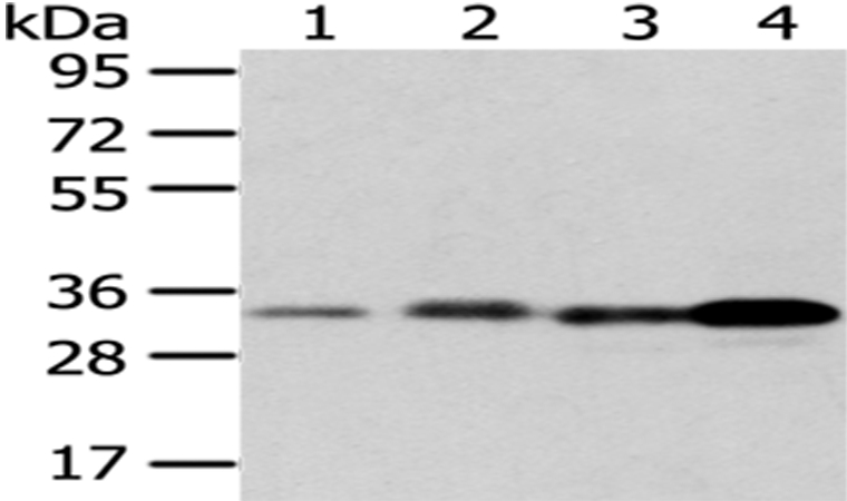 Rabbit Polyclonal Antibody to ESD