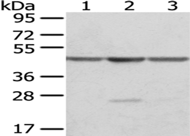 Rabbit Polyclonal Antibody to OAT